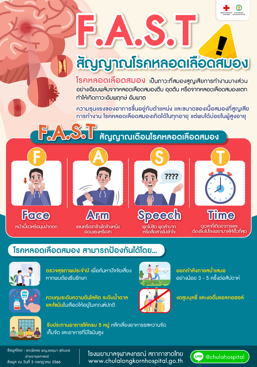 FAST-สัญญาณโรคหลอดเลือดสมอง_1